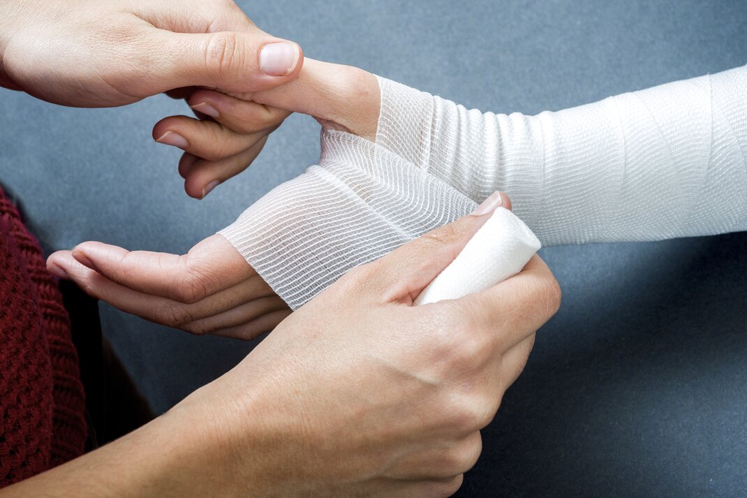 Ärztin, die eine Hand bandagiert.