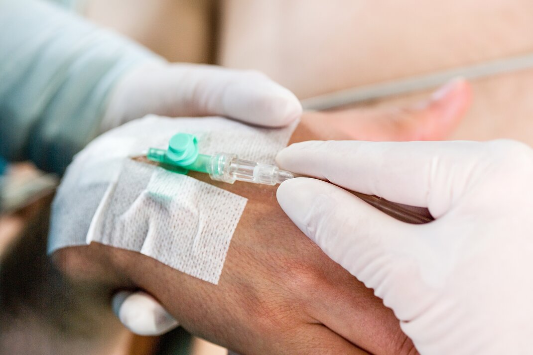 Intravenöse Infusion an der Hand